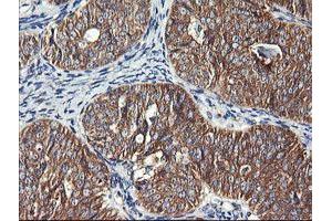 Image no. 7 for anti-Dynamin 1-Like (DNM1L) antibody (ABIN1497872)