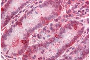 Human Small Intestine: Formalin-Fixed, Paraffin-Embedded (FFPE) (ZNF687 anticorps  (C-Term))