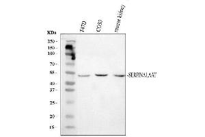 Western blot analysis of SERPINA1 using anti-SERPINA1 antibody (ABIN4886719).