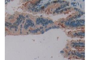 Detection of SNCG in Rat Lung Tissue using Polyclonal Antibody to Gamma-synuclein (SNCG)