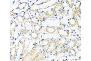 Immunohistochemistry of paraffin-embedded Mouse kidney using CTGF Polyclonal Antibody at dilution of 1:100 (40x lens). (CTGF anticorps)