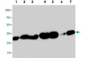 Western blot analysis of tissue extracts with PDPN polyclonal antibody . (Podoplanin anticorps  (C-Term))
