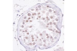 Immunohistochemistry (IHC) image for anti-Nuclear Receptor Coactivator 2 (NCOA2) (C-Term) antibody (ABIN7454615) (NCOA2 anticorps  (C-Term))
