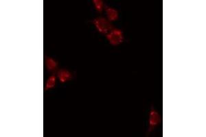 ABIN6277029 staining HuvEC by IF/ICC. (CD70 anticorps  (Internal Region))