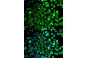 Immunofluorescence analysis of A549 cell using OSGEP antibody. (OSGEP anticorps)