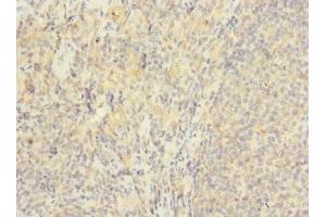 Immunohistochemistry of paraffin-embedded human tonsil tissue using ABIN7175617 at dilution of 1:100 (HVCN1 anticorps  (AA 1-100))