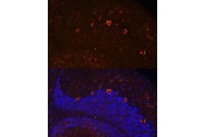Immunofluorescence analysis of mouse brain using K antibody (ABIN7268068) at dilution of 1:100.