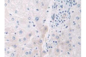 IHC-P analysis of Human Liver Tissue, with DAB staining. (IL12A anticorps  (AA 23-219))