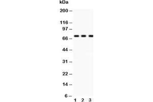 Western blot testing of p73 antibody and Lane 1:  COLO320;  2: MCF-7;  3: HeLa lysate (Tumor Protein p73 anticorps  (AA 1-198))
