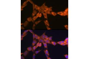 Immunofluorescence analysis of NIH-3T3 cells using 67 kDa Laminin Receptor Rabbit mAb (ABIN7270042) at dilution of 1:100 (40x lens). (RPSA/Laminin Receptor anticorps)
