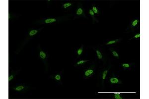 Immunofluorescence of monoclonal antibody to MYNN on HeLa cell.