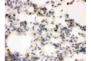 IHC analysis of Lipocalin 2 using anti-Lipocalin 2 antibody .