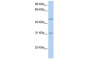 SLC39A11 antibody used at 1 ug/ml to detect target protein. (SLC39A11 anticorps)