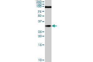 TGIF2 monoclonal antibody (M02), clone 5B11. (TGIF2 anticorps  (AA 131-236))