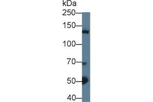 Detection of HDAC4 in Mouse Cerebrum lysate using Polyclonal Antibody to Histone Deacetylase 4 (HDAC4)