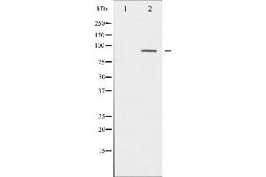 Western blot analysis of PKC alpha phosphorylation expression in UV treated NIH-3T3 whole cell lysates,The lane on the left is treated with the antigen-specific peptide.