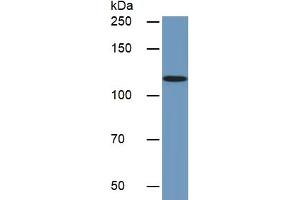 Rabbit Detection antibody from the kit in WB with Positive Control:  Sample Human Jurkat lysate. (CD31 Kit ELISA)