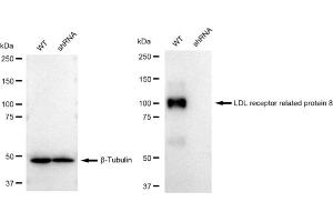 Western blotting analysis using LDL receptor related protein 8 antibody (ABIN7799283).