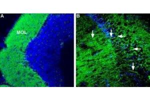 Expression of Corticotropin-releasing factor receptor 1 in mouse brain - Immunohistochemical staining of mouse hippocampus and mouse cerebellum using Anti-CRF1/CRHR1 (extracellular) Antibody (ABIN7043086, ABIN7044185 and ABIN7044186), (1:600). (CRHR1 anticorps  (Extracellular, N-Term))
