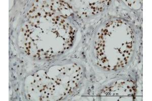 Image no. 1 for anti-Tousled-Like Kinase 1 (TLK1) (AA 111-230) antibody (ABIN599099) (TLK1 anticorps  (AA 111-230))