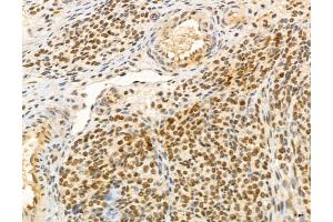 ABIN7094346 and ABIN7098393 at 1/100 staining Rat ovary tissue by IHC-P.