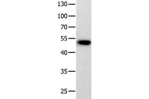 Gel: 10 % SDS-PAGE Lysate: 40 μg 823 cell Primary antibody: 1/200 dilution Secondary antibody dilution: 1/8000 Exposure time: 20 minutes (Prokineticin Receptor 2 anticorps  (N-Term))