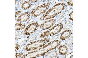 Immunohistochemistry of paraffin-embedded mouse kidney using Alkaline Phosphatase (Alkaline Phosphatase (ALPL)) Rabbit pAb (ABIN6133557, ABIN6136824, ABIN6136825 and ABIN6216013) at dilution of 1:200 (40x lens).