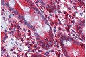 Human Small Intestine: Formalin-Fixed, Paraffin-Embedded (FFPE) (STIP1 anticorps  (AA 445-544))