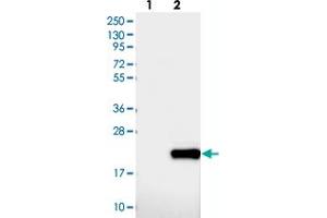 Western blot analysis of Lane 1: Negative control (vector only transfected HEK293T lysate), Lane 2: Over-expression Lysate (Co-expressed with a C-terminal myc-DDK tag (~3. (DNAJC24 anticorps)