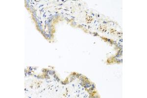 Immunohistochemistry of paraffin-embedded mouse lung using RETN antibody (ABIN5974977) at dilution of 1/100 (40x lens). (Resistin anticorps)