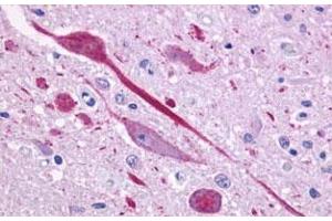Immunohistochemical (Formalin/PFA-fixed paraffin-embedded sections) staining in human brain, neurons and glia with P2RY14 polyclonal antibody . (P2RY14 anticorps  (C-Term))