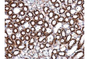 IHC-P Image ILK antibody [N1C1] detects ILK protein at cytoplasm in mouse kidney by immunohistochemical analysis.