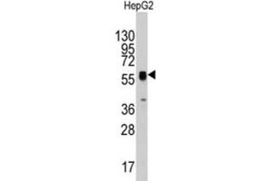 Western Blotting (WB) image for anti-Thymidine Phosphorylase (TYMP) antibody (ABIN3003120) (Thymidine Phosphorylase anticorps)