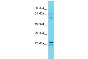 Host: Rabbit Target Name: TMEM182 Sample Type: Fetal Liver lysates Antibody Dilution: 1. (TMEM182 anticorps  (N-Term))