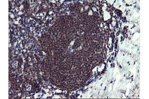 Image no. 3 for anti-Peptidylprolyl Isomerase (Cyclophilin)-Like 3 (PPIL3) antibody (ABIN1500364)