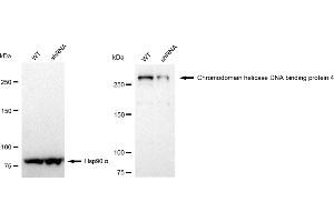 Western blotting analysis using Chromodomain helicase DNA binding protein 4 antibody (ABIN7800918).