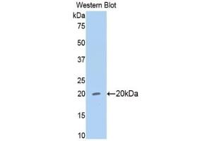 WB of Protein Standard: different control antibodies against Highly purified E. (MMP13 Kit CLIA)