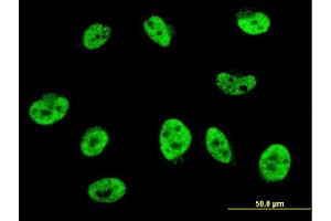 Immunofluorescence of monoclonal antibody to HES2 on HeLa cell.