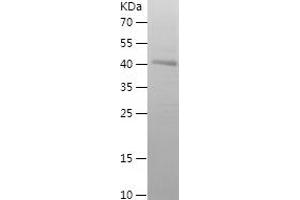 Western Blotting (WB) image for Gasdermin D (GSDMD) (AA 276-484) protein (His-IF2DI Tag) (ABIN7123056)