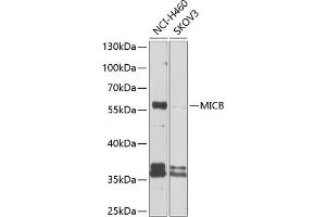 Western blot analysis of extracts of various cell lines, using MICB antibody (ABIN6133301, ABIN6143831, ABIN6143832 and ABIN6225101) at 1:1000 dilution. (MICB anticorps  (AA 23-108))