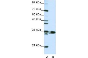 Western Blotting (WB) image for anti-Heterogeneous Nuclear Ribonucleoprotein A1 (HNRNPA1) antibody (ABIN2462116) (HNRNPA1 anticorps)