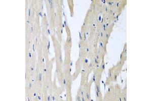 Immunohistochemistry of paraffin-embedded rat heart using PITRM1 antibody.