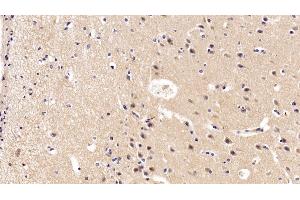 Detection of BDNF in Porcine Cerebrum Tissue using Polyclonal Antibody to Brain Derived Neurotrophic Factor (BDNF) (BDNF anticorps  (AA 20-252))