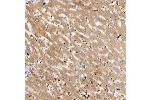 Immunohistochemical staining of human liver with AGT polyclonal antibody  shows moderate cytoplasmic positivity in hepatocytes. (AGT anticorps)