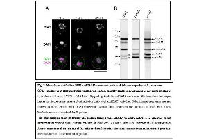 Immunofluorescence (IF) image for anti-Nucleoporin 98kDa (NUP98) (GLFG Motif), (N-Term) antibody (ABIN2452064) (NUP98 anticorps  (GLFG Motif, N-Term))
