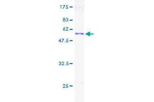 Image no. 1 for Small Nuclear Ribonucleoprotein Polypeptide N (SNRPN) (AA 1-240) protein (GST tag) (ABIN1320836)