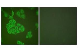 Immunofluorescence analysis of A549 cells, using MMP-11 Antibody. (MMP11 anticorps  (Internal Region))