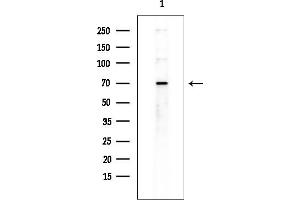 Western blot analysis of lysates from COLO205 cells(heat-shock treatment), using RBBP5 Antibody at 1/1000 dilution.