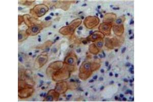IHC-P analysis of Liver tissue, with DAB staining. (BMP5 anticorps  (AA 317-454))
