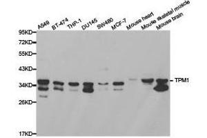 Western Blotting (WB) image for anti-Tropomyosin 1 (Alpha) (TPM1) antibody (ABIN1875180) (Tropomyosin anticorps)